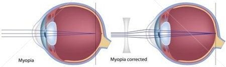 Near & Far Sightedness | What's The Difference For Your Eyes?